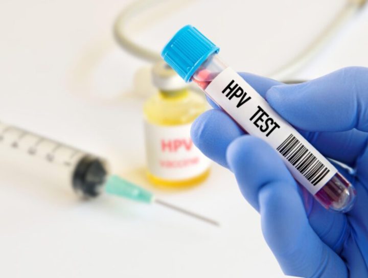 analisis en la clinica hispana vida sana del virus del papiloma humano