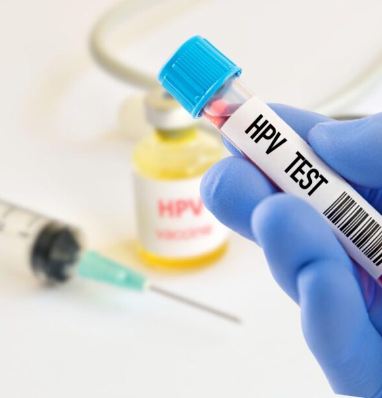 analisis en la clinica hispana vida sana del virus del papiloma humano