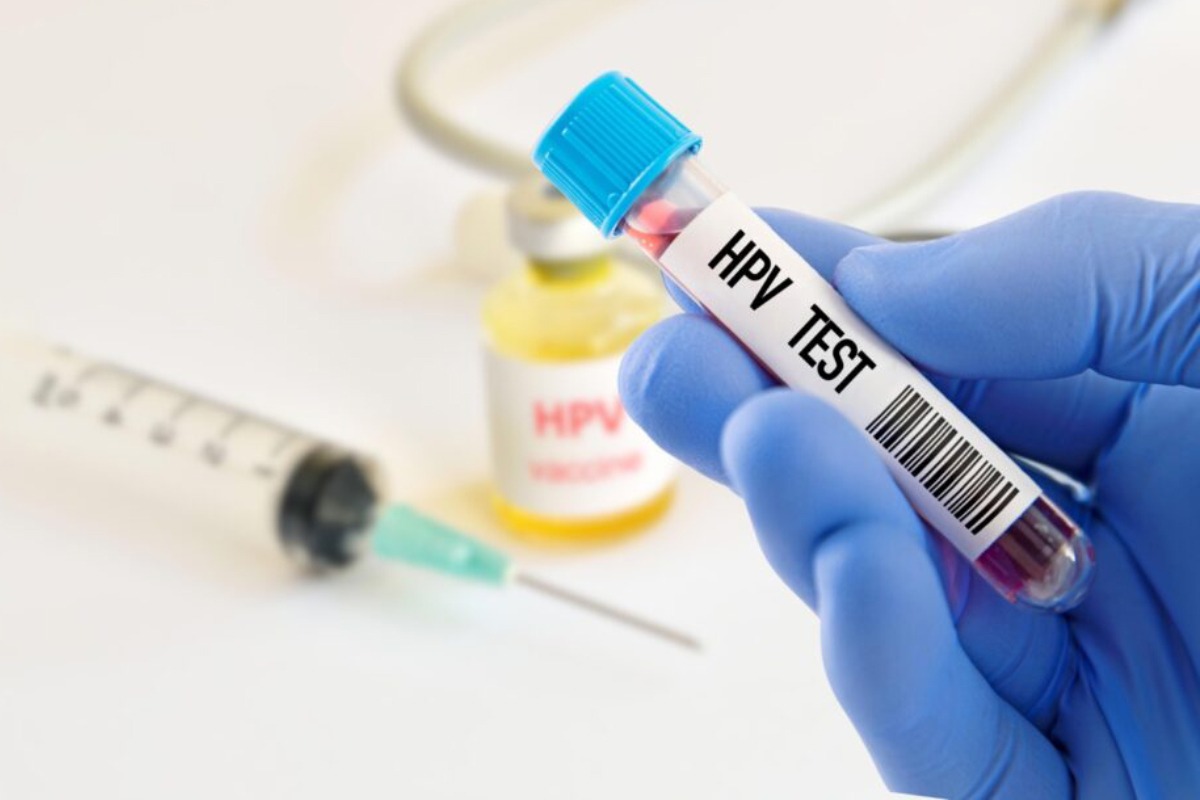 analisis en la clinica hispana vida sana del virus del papiloma humano